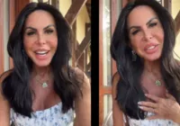 Gretchen aparece com rosto harmonizado e movimenta comentários