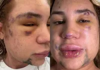 Influenciador famoso morre por complicações após procedimento estético imagem