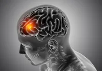 Influenciadora famosa revela aneurisma cerebral: “Semana difícil”