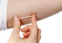MPBA pede suspensão de implantes hormonais por irregularidades graves imagem