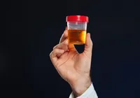Urina como comida? Cientistas testam novo tipo de alimento imagem