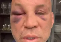 Wanderlei Silva relata dores na cabeça e desabafa após briga com Popó imagem