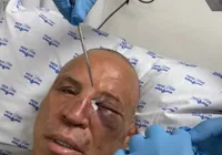 Wanderlei processará agressor por tentativa de homicídio, diz advogado imagem