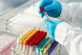 Estudo revela que esse tipo sanguíneo tem maior risco de infarto - Imagem