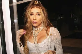 Massafera revela infecção após cirurgia no rosto: "Não paro de chorar" - Imagem