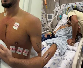 13 tiros: influenciador sai da UTI após bala estilhaçar e parar no coração