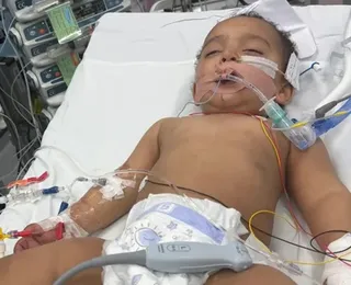 Bebê confunde soda cáustica com leite e perde metade da língua