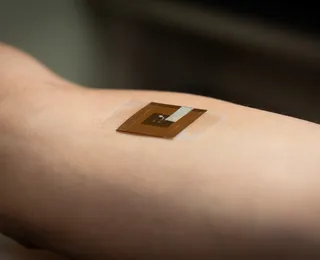 Câncer de pele: adesivo promete identificar risco da doença