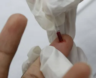 Cientistas descobrem anticorpo supereficaz contra o HIV