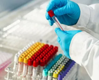 Estudo revela que esse tipo sanguíneo tem maior risco de infarto