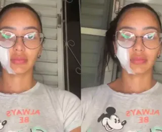 Ex-bailarina do Faustão é esfaqueada pela mãe e pede ajuda na web