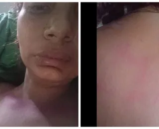 Ilhéus: polícia nega morte de garota de programa por estupro e revela causa