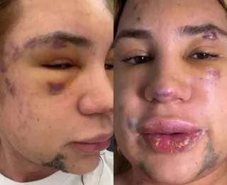 Influenciador famoso morre por complicações após procedimento estético