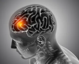 Influenciadora famosa revela aneurisma cerebral: “Semana difícil”