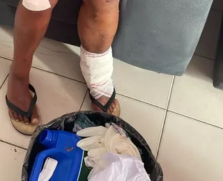 Lar de idosos é fechado por condições precárias em Salvador