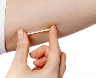 MPBA pede suspensão de implantes hormonais por irregularidades graves