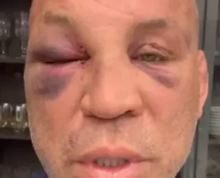 Wanderlei Silva relata dores na cabeça e desabafa após briga com Popó