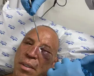 Wanderlei processará agressor por tentativa de homicídio, diz advogado