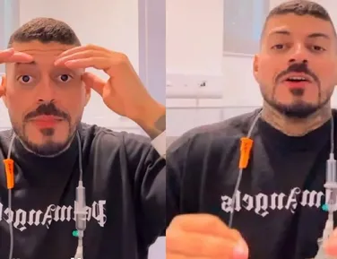 Influenciador perde dedo do pé após cachorro comê-lo enquanto dormia - Imagem