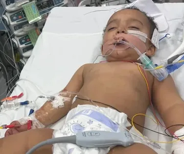 Bebê confunde soda cáustica com leite e perde metade da língua - Imagem