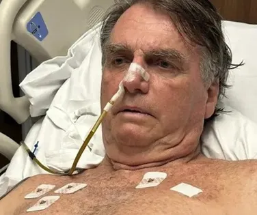 Filho de Bolsonaro revela estado de saúde crítico do pai: “Fatal” - Imagem