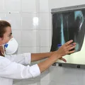 Brasil não atinge meta da OMS e tem aumento de casos de tuberculose imagem