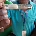 Casos de dengue na Bahia registram queda de mais de 85% em 2025 imagem
