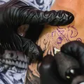 Homem passa por 7 cirurgias após apresentar alergia a tatuagem imagem