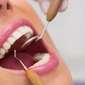 O hábito de dois minutos que pode salvar você de um AVC imagem