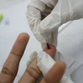 Registro de HIV entre idosos aumenta 441% em 10 anos e preocupa especialistas imagem