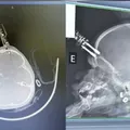 Bebê de 1 ano cai da cama e fica com carregador cravado na testa imagem