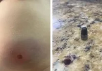 Bebê de 11 meses é vítima de bala perdida dentro de casa no revéillon