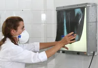 Brasil não atinge meta da OMS e tem aumento de casos de tuberculose imagem