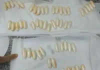 Homem engole 80 cápsulas de cocaína e é preso em aeroporto