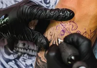 Homem passa por 7 cirurgias após apresentar alergia a tatuagem imagem