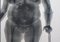 Idosa tenta entrar na Cadeia de Salvador com drogas e eletrônicos