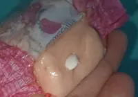 Menina passa mal após comer doce dado por 'Papais Noéis'