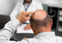 Minoxidil e mais: Anvisa proíbe produtos capilares e de limpeza imagem