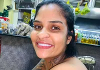 Mulher atropelada e arrastada pelo ex passará por nova amputação imagem
