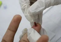 Registro de HIV entre idosos aumenta 441% em 10 anos e preocupa especialistas