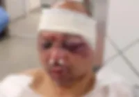 Rodoviário de Salvador é espancado por moradores após suspeita de aliciar adolescente imagem