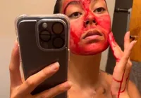 Sangue menstrual: nova tendência de skincare? Entenda os riscos imagem