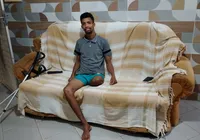 "Se não demorasse tanto tinha como recuperar", diz entregador amputado imagem