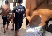 Adolescente de 13 anos morre após ataque de tubarão em Pernambuco