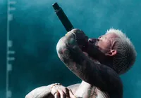 Cantor famoso fica irreconhecível após transplante capilar