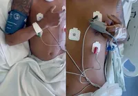 Jovem tetraplégico mexe os braços após tratamento revolucionário imagem