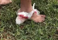 Medo: ataque de piranhas deixa dez feridos em rio no interior da Bahia