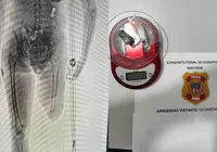 Mulher tenta entrar em presídio com material proibido dentro da muleta