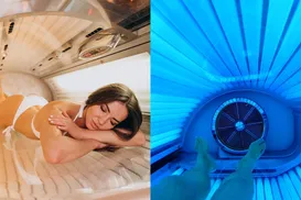 Bronzeamento pode danificar severamente DNA da pele - Imagem