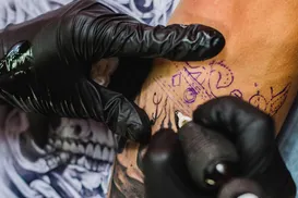 Homem passa por 7 cirurgias após apresentar alergia a tatuagem - Imagem